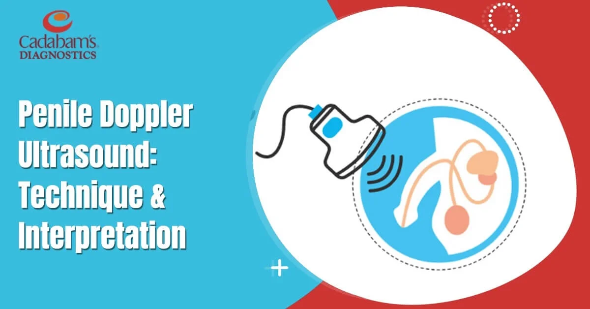 Penile Doppler Ultrasound: A Key to Male Health