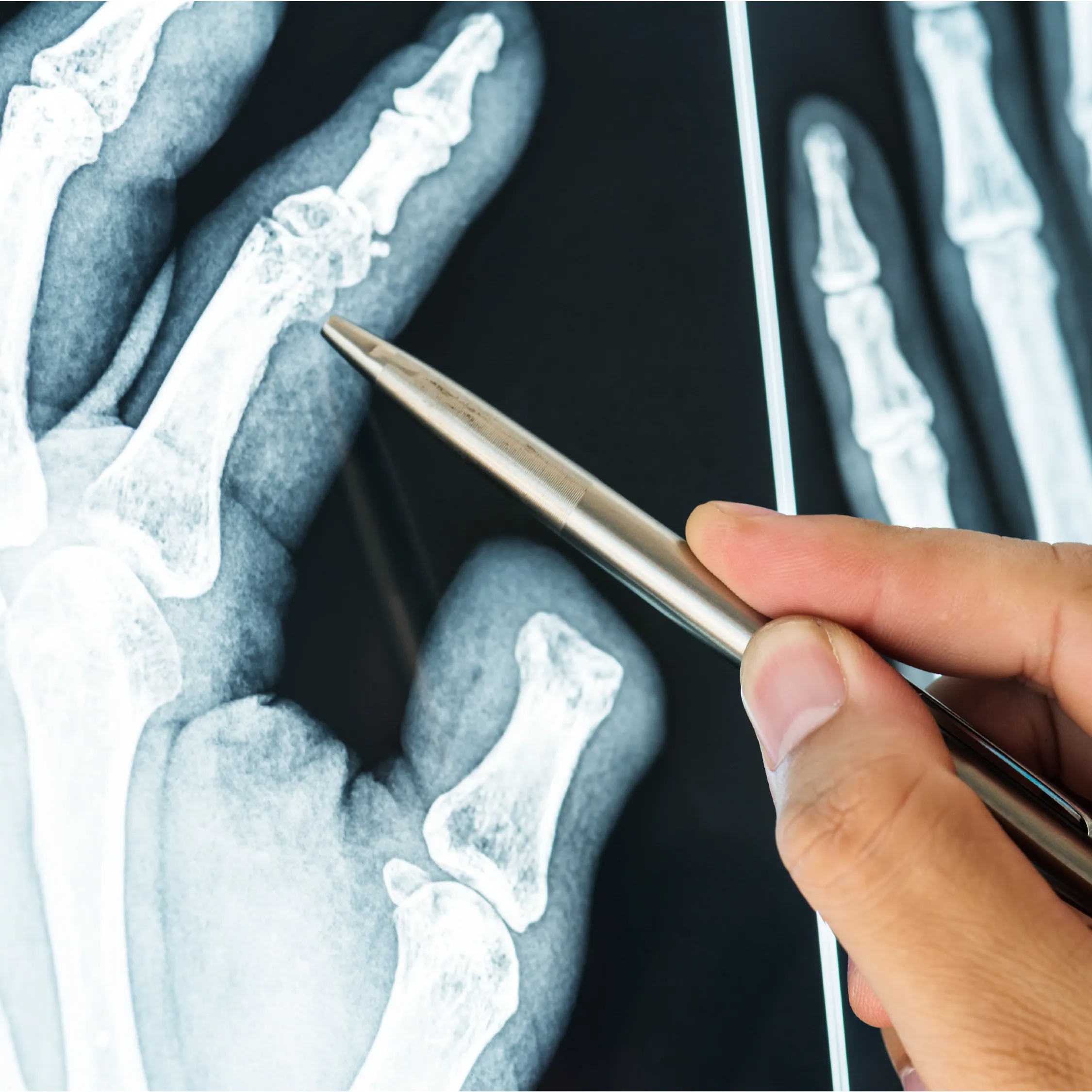 Reasons for Taking an X-ray